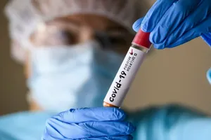Эпидемиологическая ситуация по COVID-19 в Казахстане стабильная – Минздрав